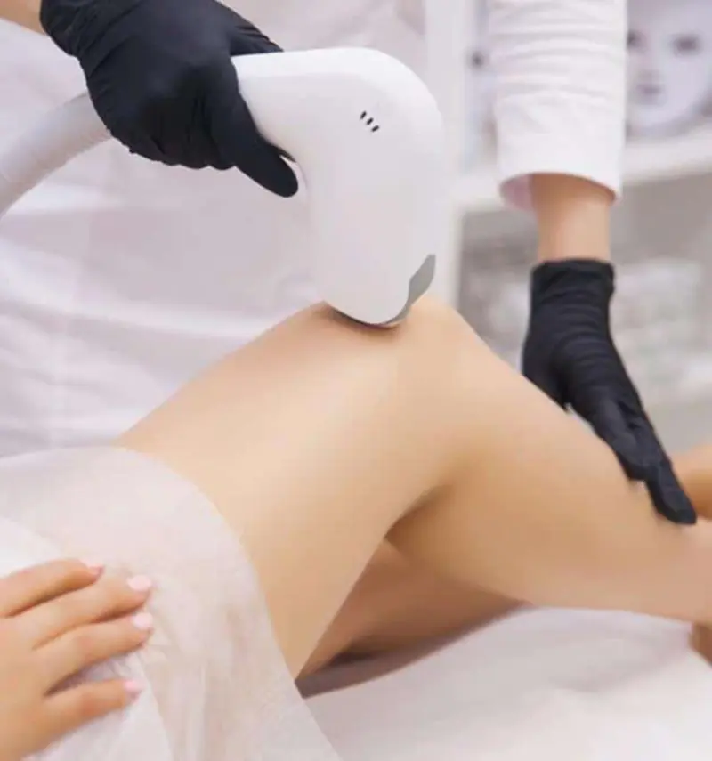 Laser Hair Removal Treatment Laser Hair Removal Treatment